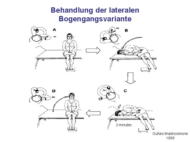 Behandlung der lateralen Bogengangsvariante 2 minutes Gufoni-Mastrosimone 1999 