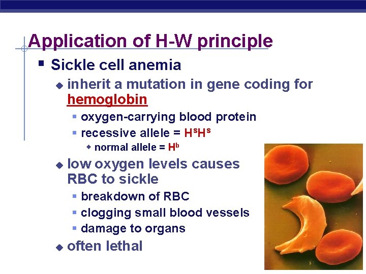 Application of H-W principle § Sickle cell anemia u inherit a mutation in gene