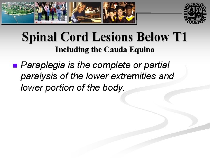 Spinal Cord Lesions Below T 1 Including the Cauda Equina n Paraplegia is the