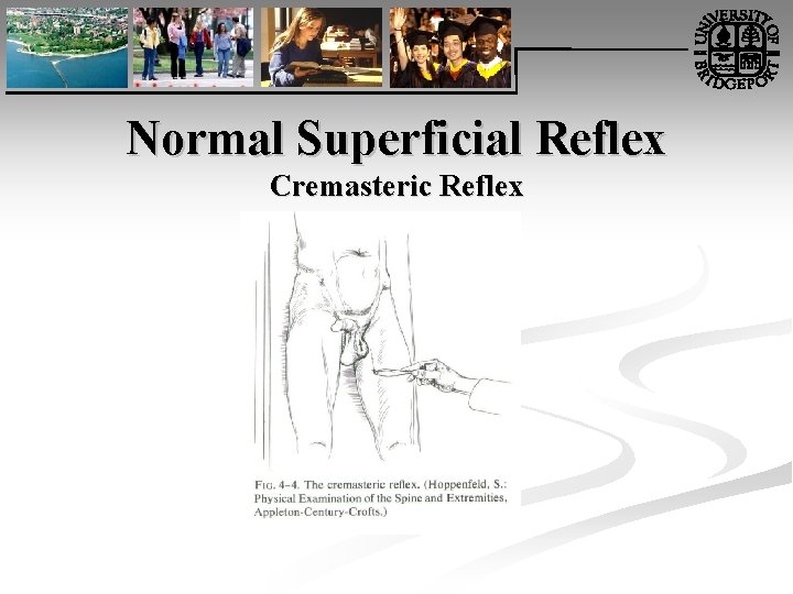 Normal Superficial Reflex Cremasteric Reflex 