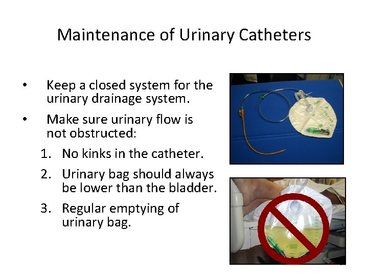 Maintenance of Urinary Catheters Keep a closed system for the urinary drainage system. •