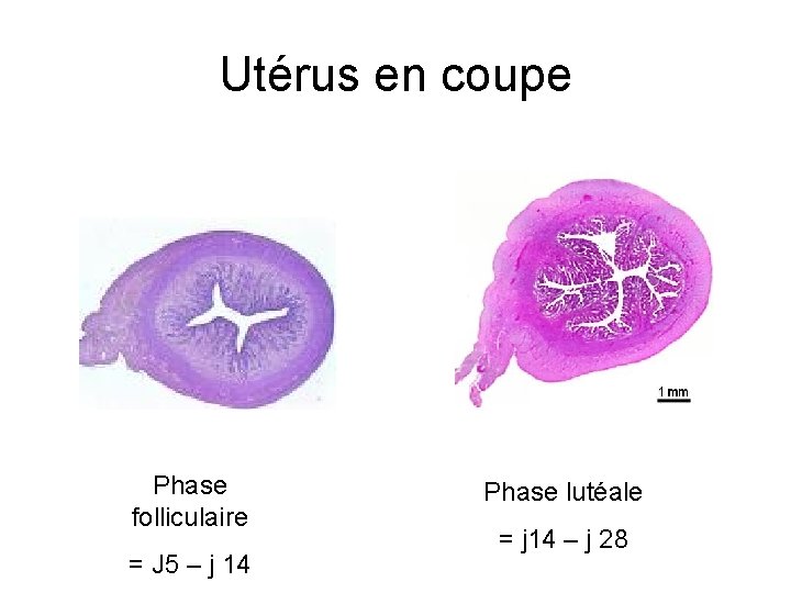 Utérus en coupe Phase folliculaire = J 5 – j 14 Phase lutéale =