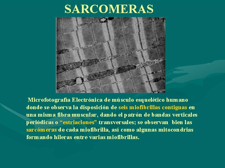 SARCOMERAS Microfotografía Electrónica de músculo esquelético humano donde se observa la disposición de seis