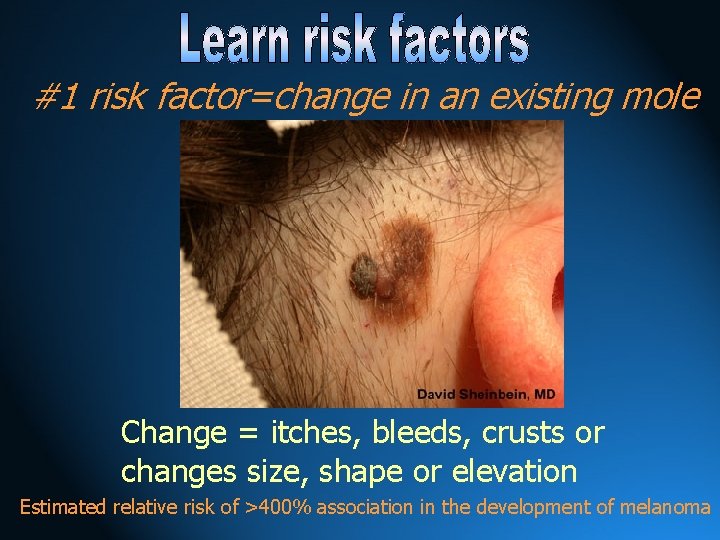 #1 risk factor=change in an existing mole Change = itches, bleeds, crusts or changes
