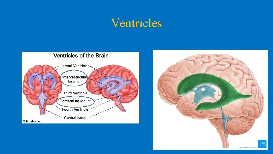 Ventricles 
