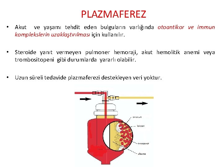 PLAZMAFEREZ • Akut ve yaşamı tehdit eden bulguların varlığında otoantikor ve immun komplekslerin uzaklaştırılması