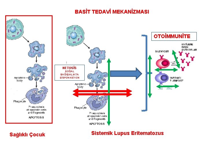 BASİT TEDAVİ MEKANİZMASI OTOİMMUNİTE NETOSİS DOĞAL BAĞIŞIKLIKTA DİSFONKSİYON Sağlıklı Çocuk Sistemik Lupus Eritematozus 