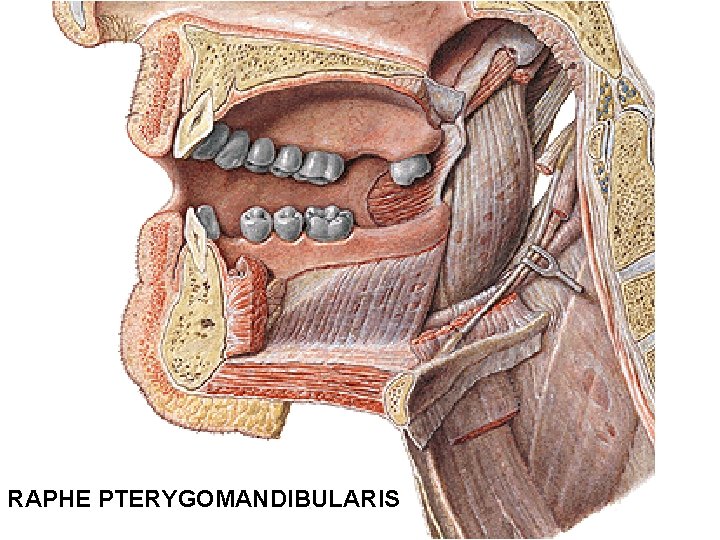 RAPHE PTERYGOMANDIBULARIS 