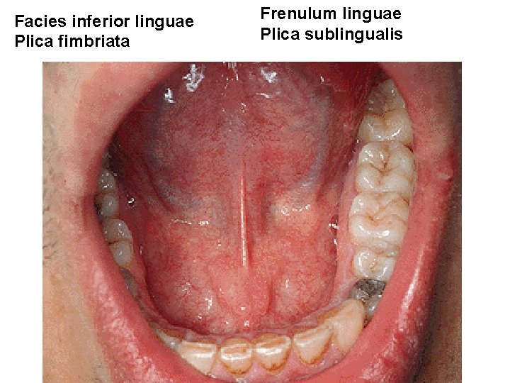 Facies inferior linguae Plica fimbriata Frenulum linguae Plica sublingualis 