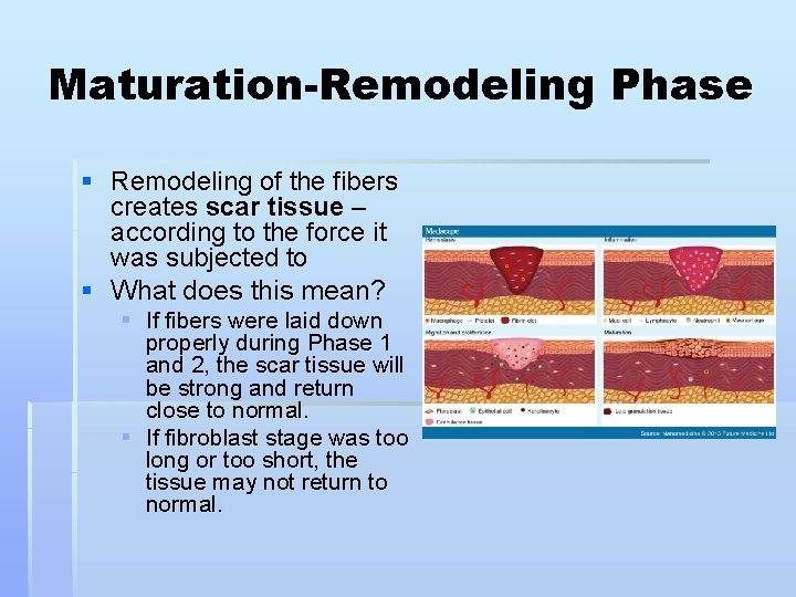 Maturation-Remodeling Phase § Remodeling of the fibers creates scar tissue – according to the