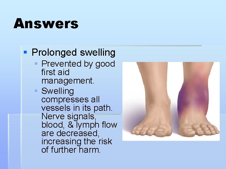 Answers § Prolonged swelling § Prevented by good first aid management. § Swelling compresses
