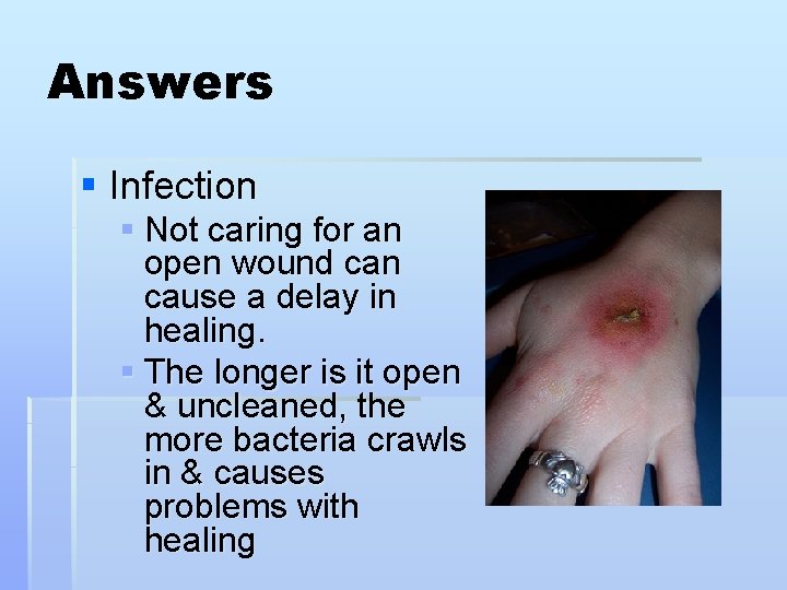 Answers § Infection § Not caring for an open wound can cause a delay