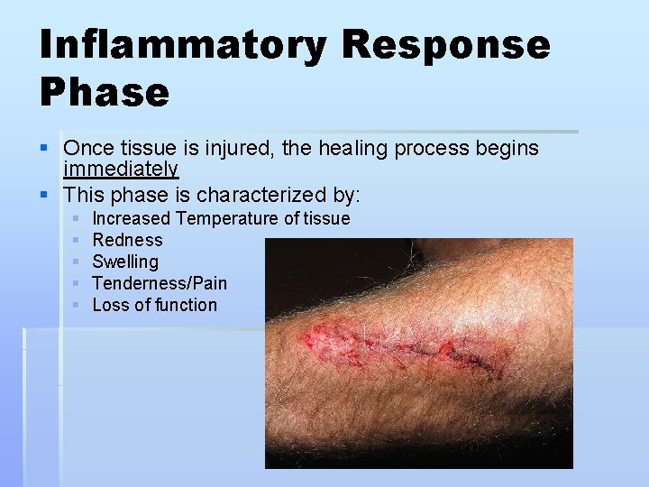 Inflammatory Response Phase § Once tissue is injured, the healing process begins immediately §