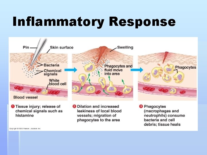 Inflammatory Response 
