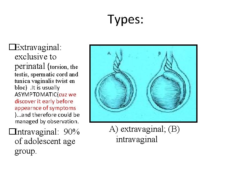 Types: �Extravaginal: exclusive to perinatal (torsion, the testis, spermatic cord and tunica vaginalis twist
