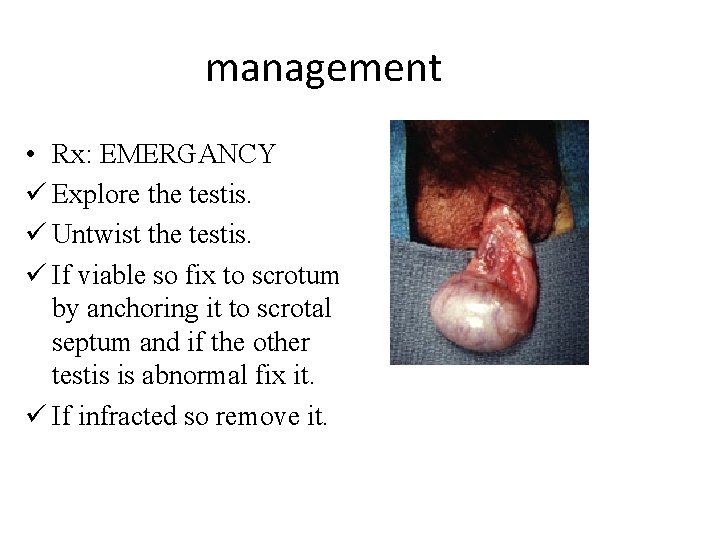 management • Rx: EMERGANCY ü Explore the testis. ü Untwist the testis. ü If