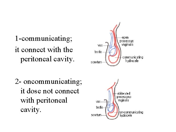 1 -communicating; it connect with the peritoneal cavity. 2 - oncommunicating; it dose not