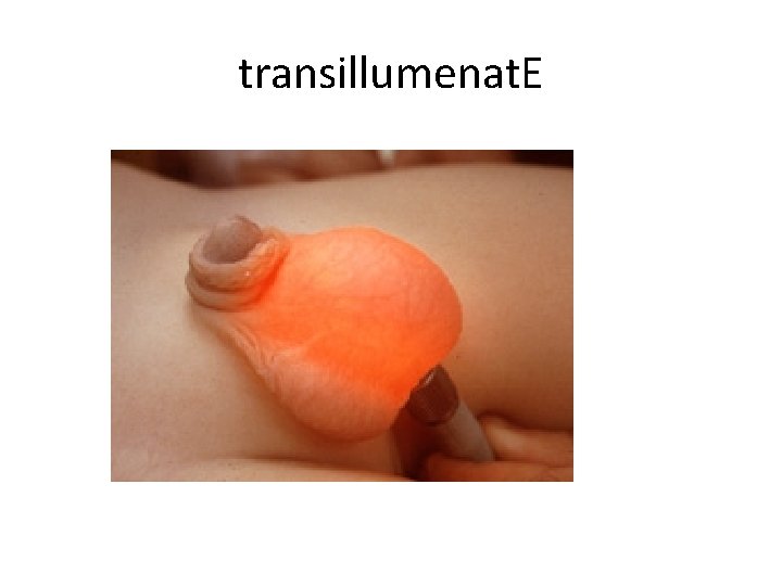 transillumenat. E 