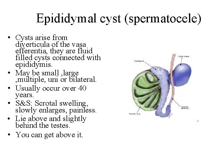 Epididymal cyst (spermatocele) • Cysts arise from diverticula of the vasa efferentia, they are