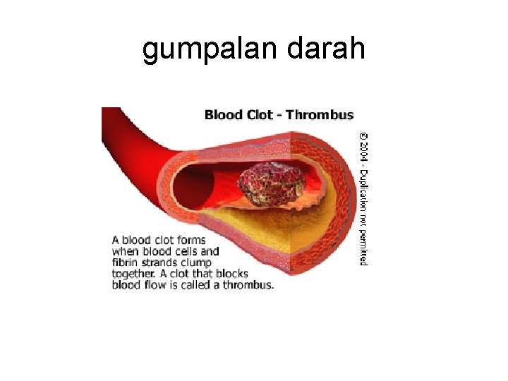 gumpalan darah 