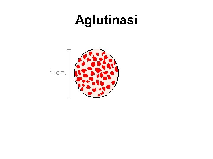 Aglutinasi 