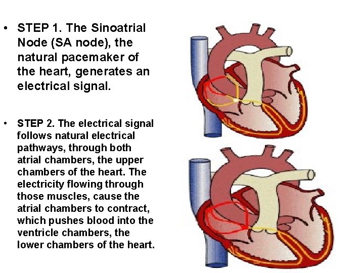  • STEP 1. The Sinoatrial Node (SA node), the natural pacemaker of the