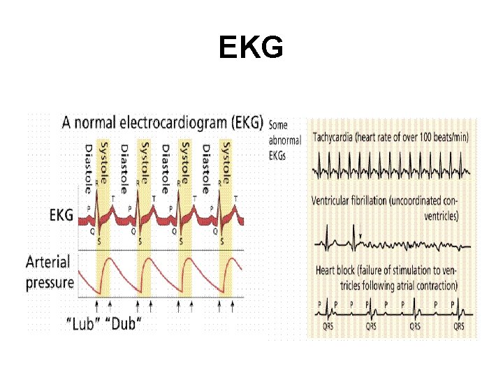 EKG 