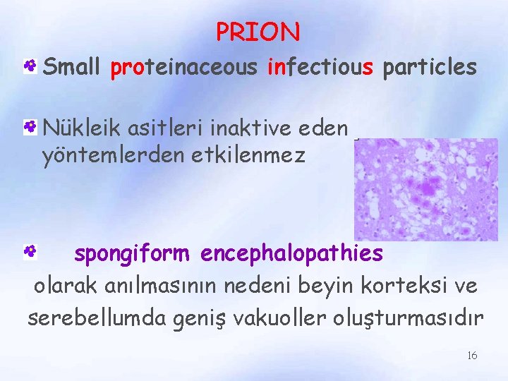 PRION Small proteinaceous infectious particles Nükleik asitleri inaktive eden yöntemlerden etkilenmez spongiform encephalopathies olarak