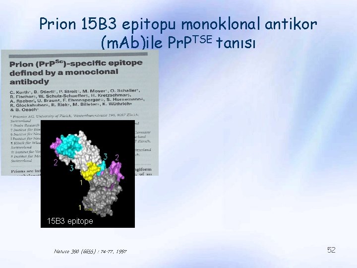 Prion 15 B 3 epitopu monoklonal antikor (m. Ab)ile Pr. PTSE tanısı 15 B