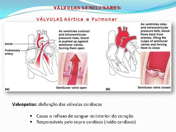 VÁLVULAS S E M I L U N A R E S VÁLVULAS A