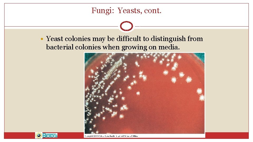 Fungi: Yeasts, cont. • Yeast colonies may be difficult to distinguish from bacterial colonies