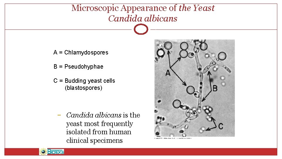 Microscopic Appearance of the Yeast Candida albicans A = Chlamydospores B = Pseudohyphae C