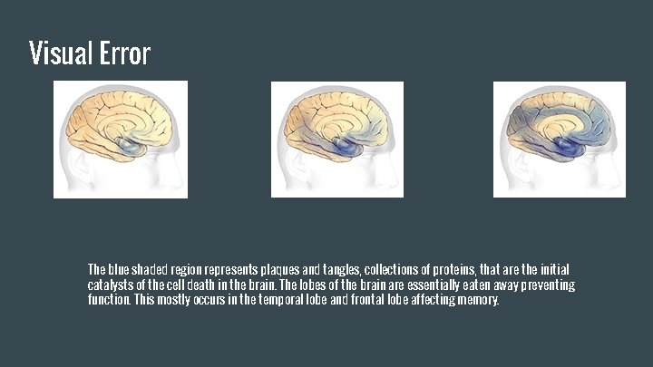 Patient 2 Emma Collena Mallory and Hannah Background