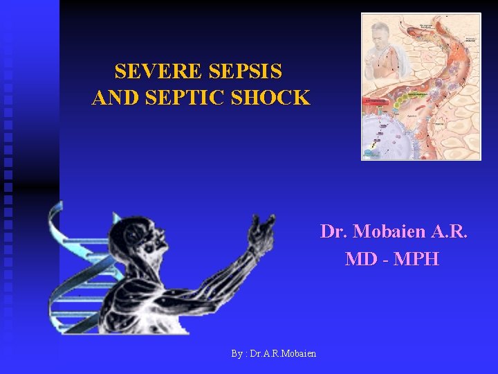 SEVERE SEPSIS AND SEPTIC SHOCK Dr. Mobaien A. R. MD - MPH By :