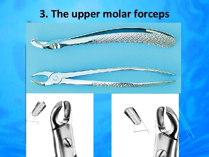 3. The upper molar forceps 