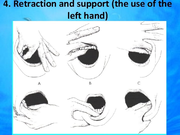 4. Retraction and support (the use of the left hand) 