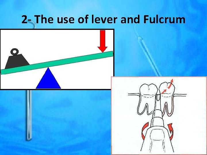 2 - The use of lever and Fulcrum 