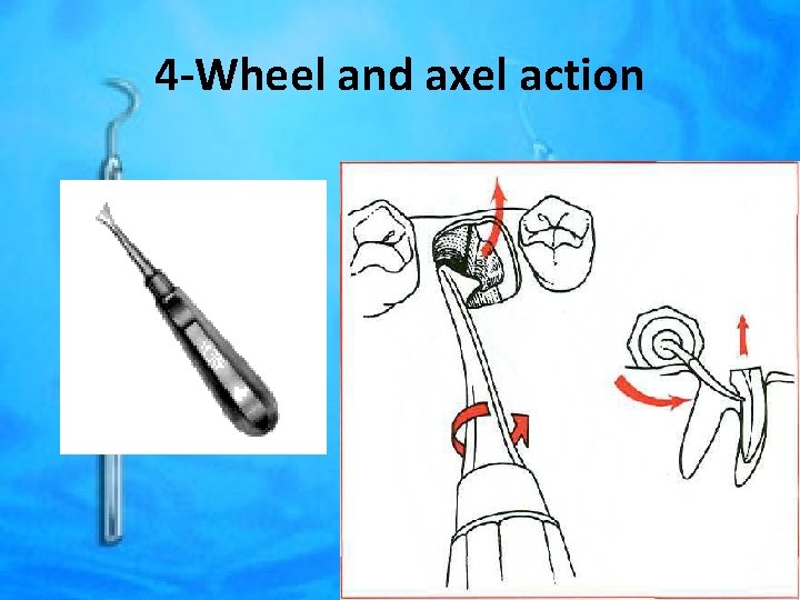 4 -Wheel and axel action 