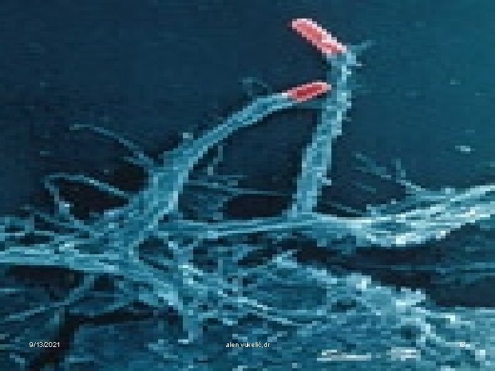 9/13/2021 alen vukelić, dr 13 