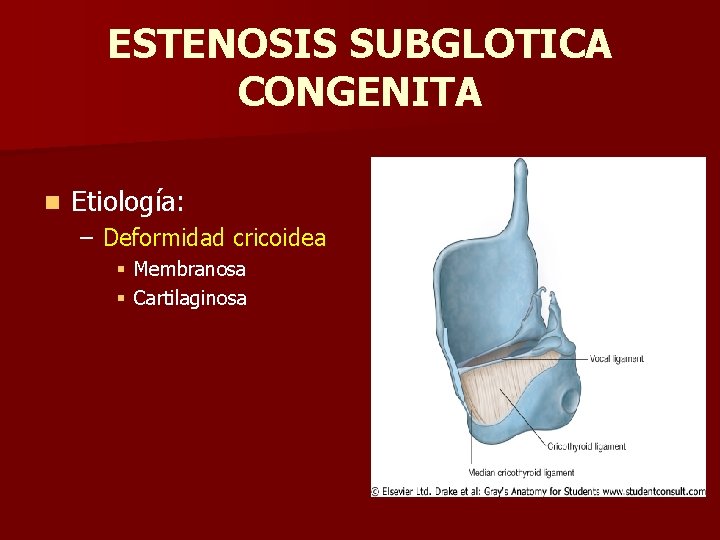 ESTENOSIS SUBGLOTICA CONGENITA n Etiología: – Deformidad cricoidea § Membranosa § Cartilaginosa ESTENOSIS SUBGLOTICA CONGENITA n Etiología: – Deformidad cricoidea § Membranosa § Cartilaginosa