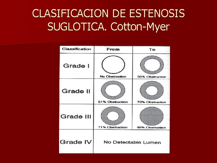 CLASIFICACION DE ESTENOSIS SUGLOTICA. Cotton-Myer CLASIFICACION DE ESTENOSIS SUGLOTICA. Cotton-Myer
