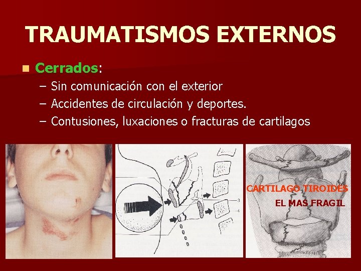 TRAUMATISMOS EXTERNOS n Cerrados: – Sin comunicación con el exterior – Accidentes de circulación TRAUMATISMOS EXTERNOS n Cerrados: – Sin comunicación con el exterior – Accidentes de circulación