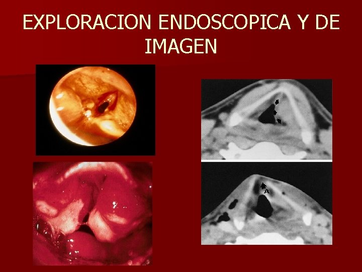 EXPLORACION ENDOSCOPICA Y DE IMAGEN EXPLORACION ENDOSCOPICA Y DE IMAGEN