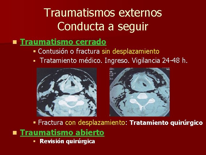 Traumatismos externos Conducta a seguir n Traumatismo cerrado § Contusión o fractura sin desplazamiento Traumatismos externos Conducta a seguir n Traumatismo cerrado § Contusión o fractura sin desplazamiento