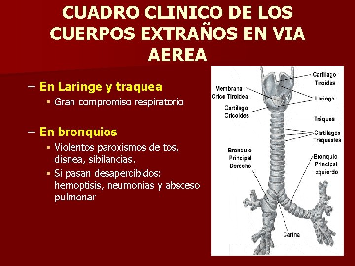CUADRO CLINICO DE LOS CUERPOS EXTRAÑOS EN VIA AEREA – En Laringe y traquea CUADRO CLINICO DE LOS CUERPOS EXTRAÑOS EN VIA AEREA – En Laringe y traquea