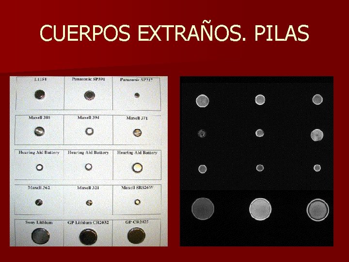 CUERPOS EXTRAÑOS. PILAS CUERPOS EXTRAÑOS. PILAS