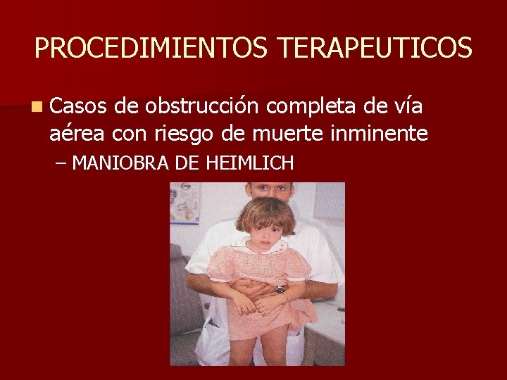 PROCEDIMIENTOS TERAPEUTICOS n Casos de obstrucción completa de vía aérea con riesgo de muerte PROCEDIMIENTOS TERAPEUTICOS n Casos de obstrucción completa de vía aérea con riesgo de muerte