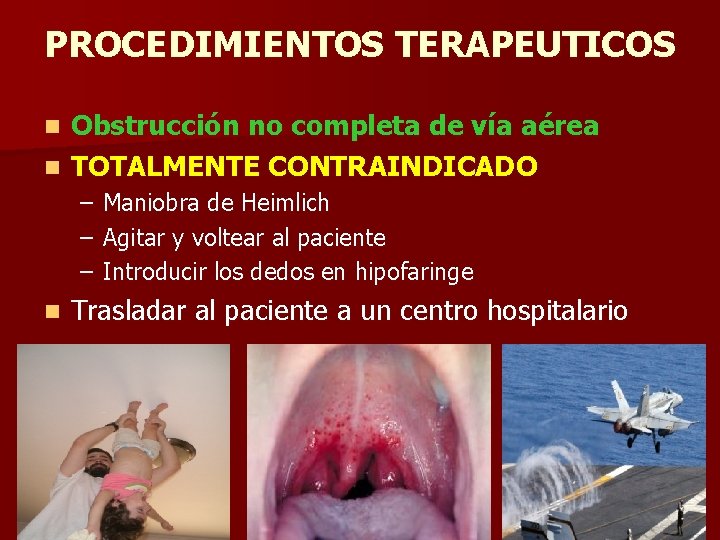 PROCEDIMIENTOS TERAPEUTICOS Obstrucción no completa de vía aérea n TOTALMENTE CONTRAINDICADO n – – PROCEDIMIENTOS TERAPEUTICOS Obstrucción no completa de vía aérea n TOTALMENTE CONTRAINDICADO n – –