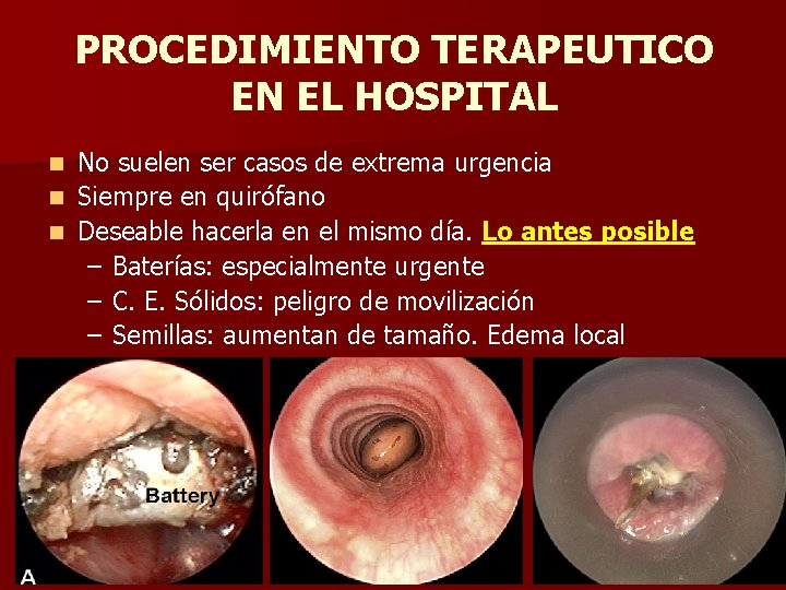 PROCEDIMIENTO TERAPEUTICO EN EL HOSPITAL No suelen ser casos de extrema urgencia n Siempre PROCEDIMIENTO TERAPEUTICO EN EL HOSPITAL No suelen ser casos de extrema urgencia n Siempre