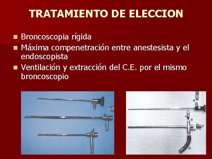 TRATAMIENTO DE ELECCION Broncoscopia rígida n Máxima compenetración entre anestesista y el endoscopista n TRATAMIENTO DE ELECCION Broncoscopia rígida n Máxima compenetración entre anestesista y el endoscopista n